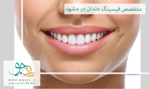 متخصص فیسینگ دندان در مشهد