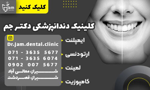 بهترین دکتر دندانپزشک در شیراز