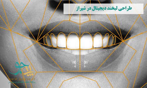 بهترین طراحی لبخند دیجیتال در شیراز