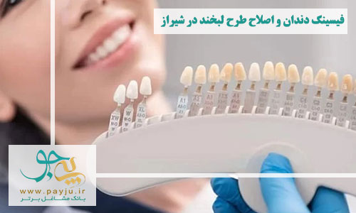 دندانپزشکان متخصص فیسینگ دندان و اصلاح طرح لبخند در شیراز