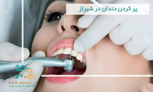پر کردن دندان در شیراز