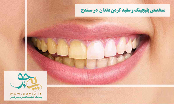 لیست دندانپزشکان متخصص بلیچینگ و سفید کردن دندان در سنندج