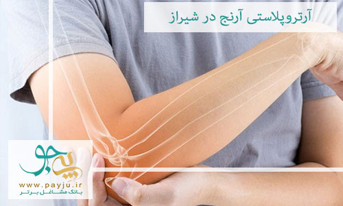 آرتروپلاستی آرنج در شیراز آرتروپلاستی آرنج در شیراز