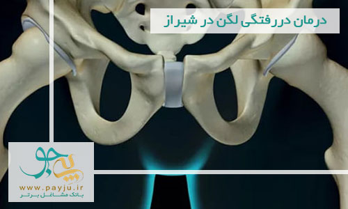 درمان دررفتگی لگن در شیراز درمان دررفتگی لگن در شیراز