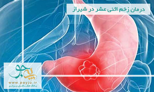 درمان زخم اثنی عشر در شیراز درمان زخم اثنی عشر در شیراز