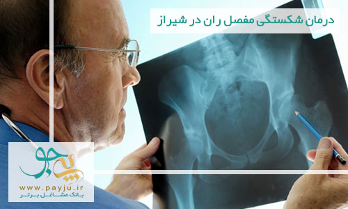 درمان شکستگی مفصل ران در شیراز