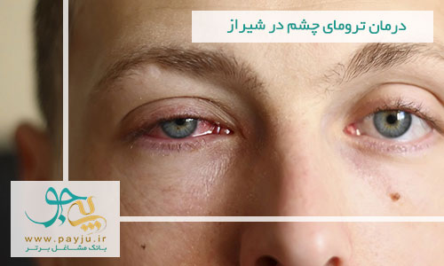 درمان ترومای چشم در شیراز