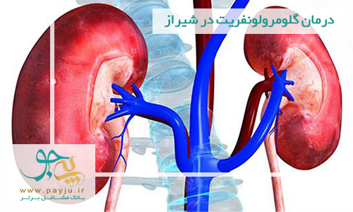 درمان گلومرولونفریت در شیراز