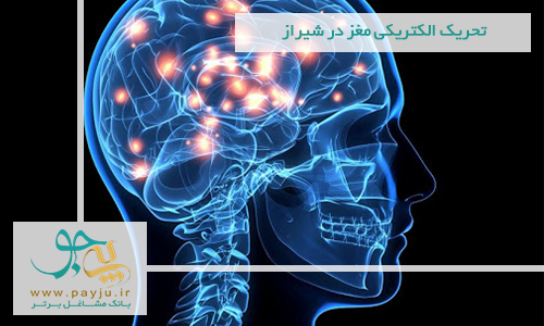تحریک الکتریکی مغز در شیراز