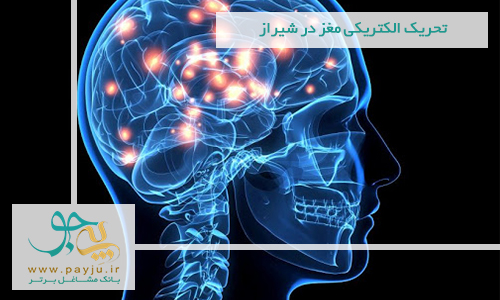 تحریک الکتریکی مغز در شیراز تحریک الکتریکی مغز در شیراز