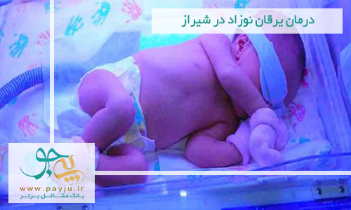 درمان یرقان نوزاد در شیراز