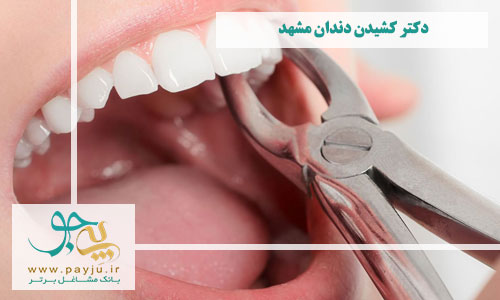 دکتر کشیدن دندان مشهد