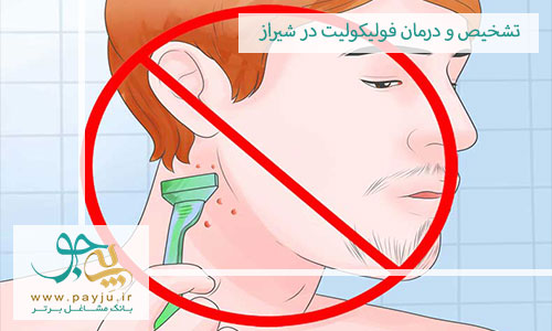تشخیص و درمان فولیکولیت در شیراز