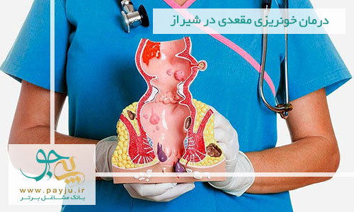 درمان خونریزی مقعدی در شیراز