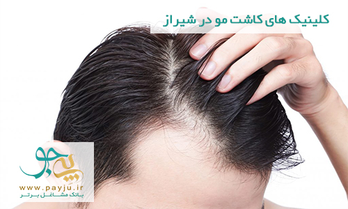لیست کلینیک های کاشت مو در شیراز کلینیک کاشت مو در شیراز